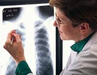 Billede af en kvindelig radiolog læser en x-ray